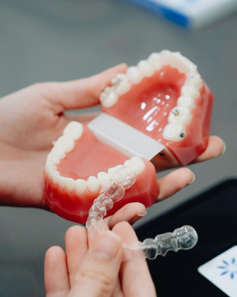 Hands holding a dental model and a clear aligner