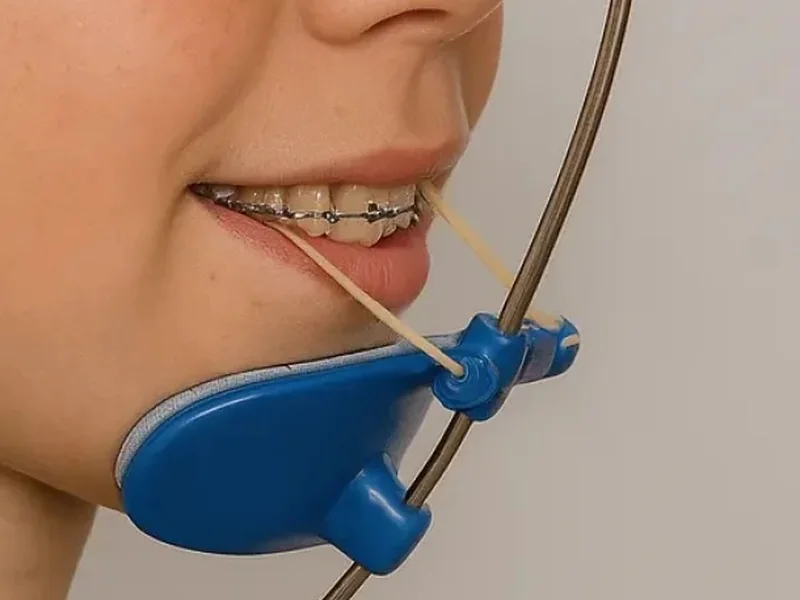 A facemask (reverse-pull headgear) in use: chin pad, support bar and elastics